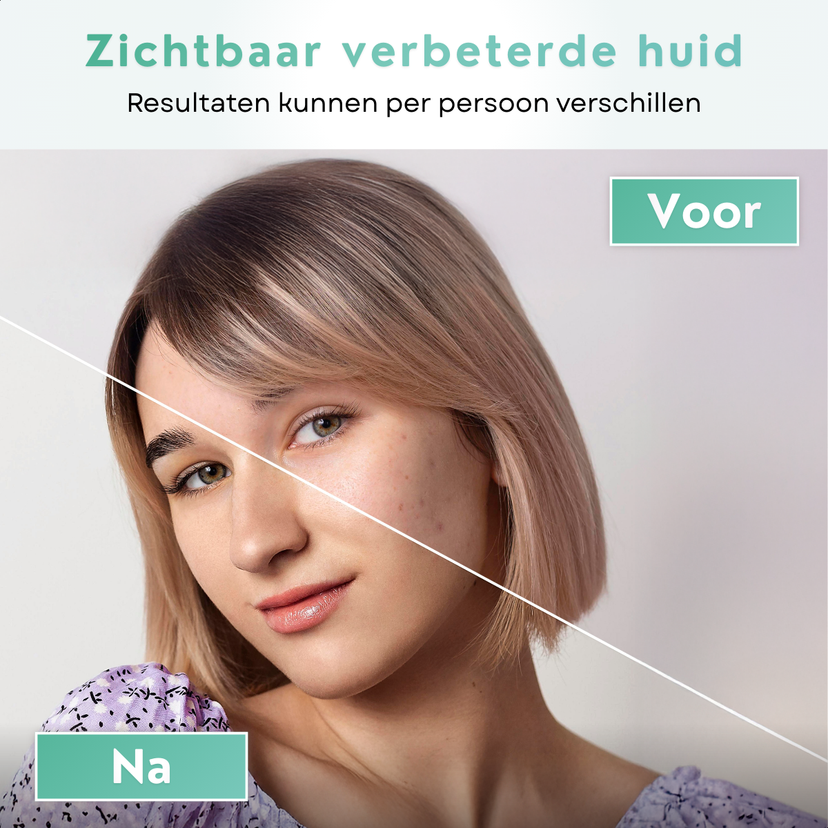 Vorher- und Nachherbild eines Gesichts mit sichtbarer Hautverbesserung nach der Anwendung einer Gesichtsmaske.