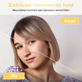 collagen-glow-mask-voor-na-resultaat.jpg: Vorher-Nachher-Ergebnis der Anwendung einer Kollagen-Gesichtsmaske.
